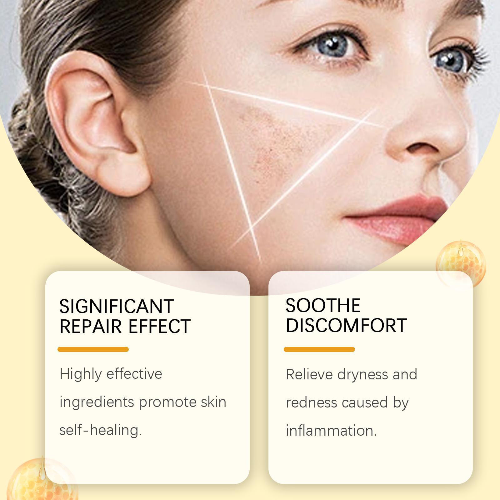 Houkeya Bee  Skin Care Cream Gentle Cleansing, Mole Removal, Moisturizing, Soothing Skin Care Cream - DropOnline.co