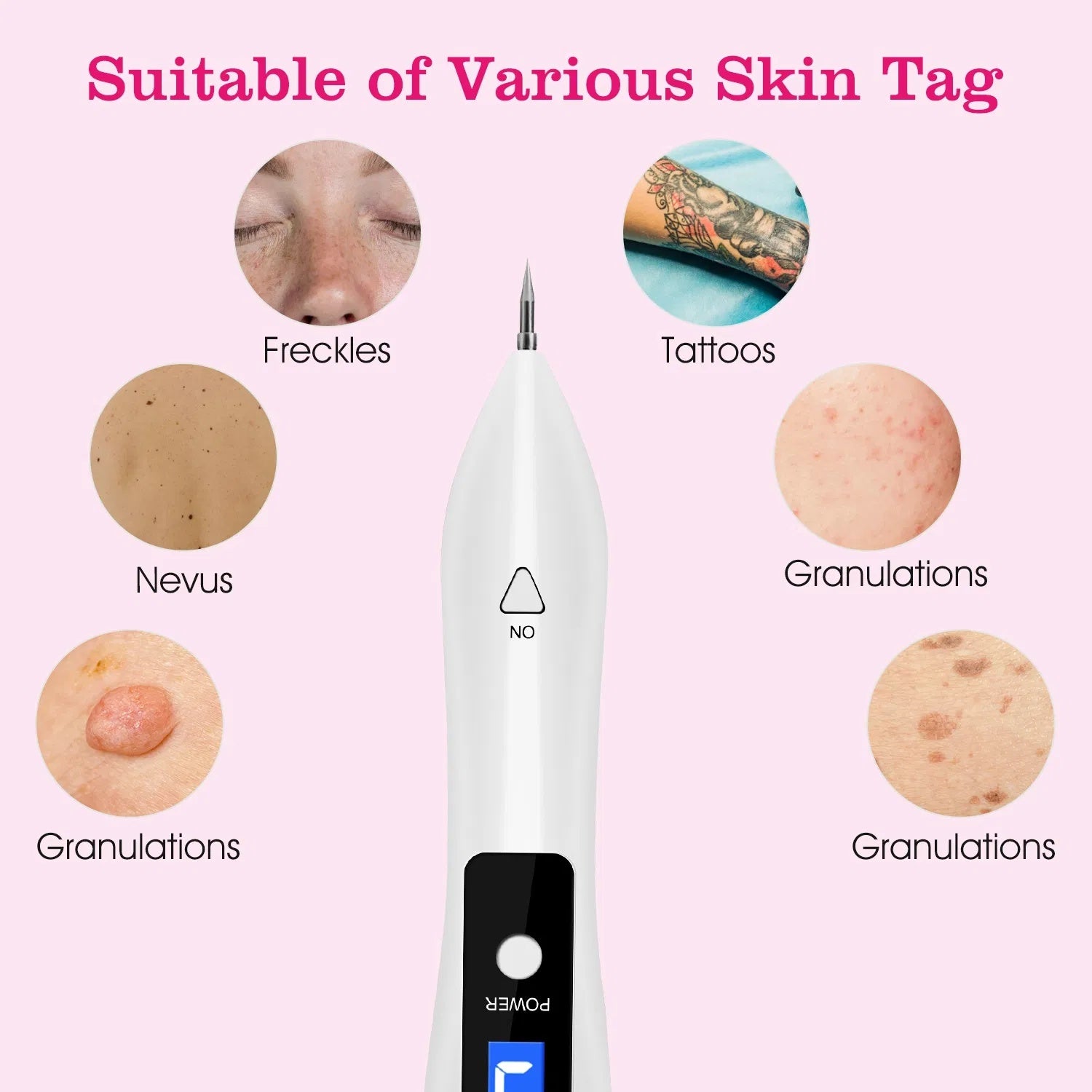 Skin Tag Repair Kit Portable Beauty Equipment Multi-Level With Home Usage USB Charging LCD Level Adjustable 6 Replaceable Needles - DropOnline.co