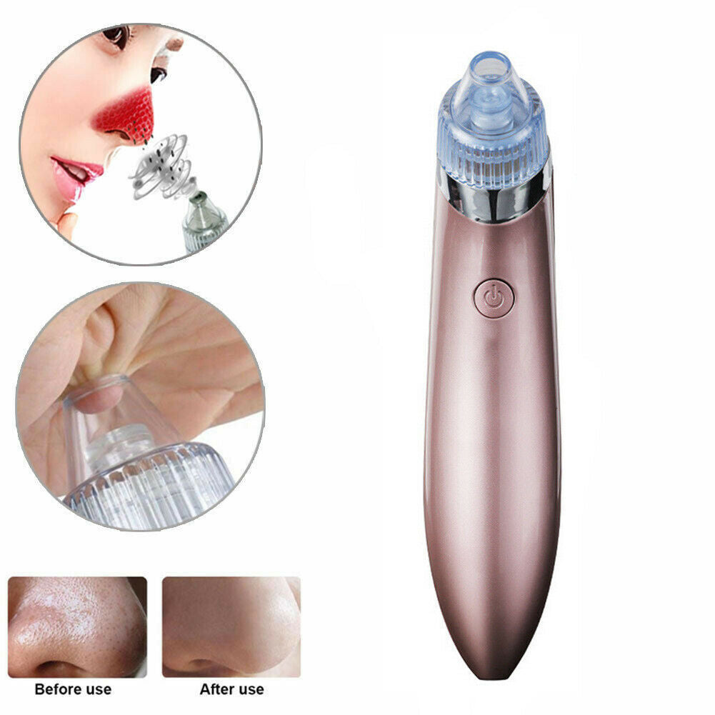 Electric Blackhead Vacuum Pore Cleaner Acne Pimple Remover Strong Suction Tool Electric Blackhead Remover Pore Vacuum Suction Diamond Dermabrasion Face Cleaner - DropOnline.co