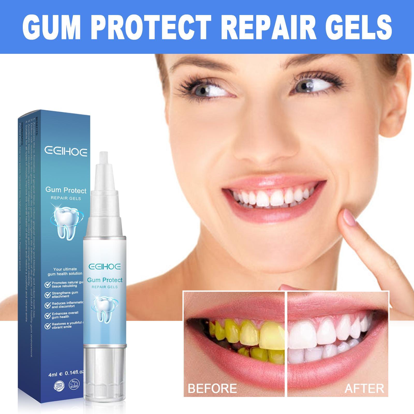 Yierhao Tooth Repair Gel, Repair Gums, Clean Teeth Stains, Tartar, Oral Care - DropOnline.co