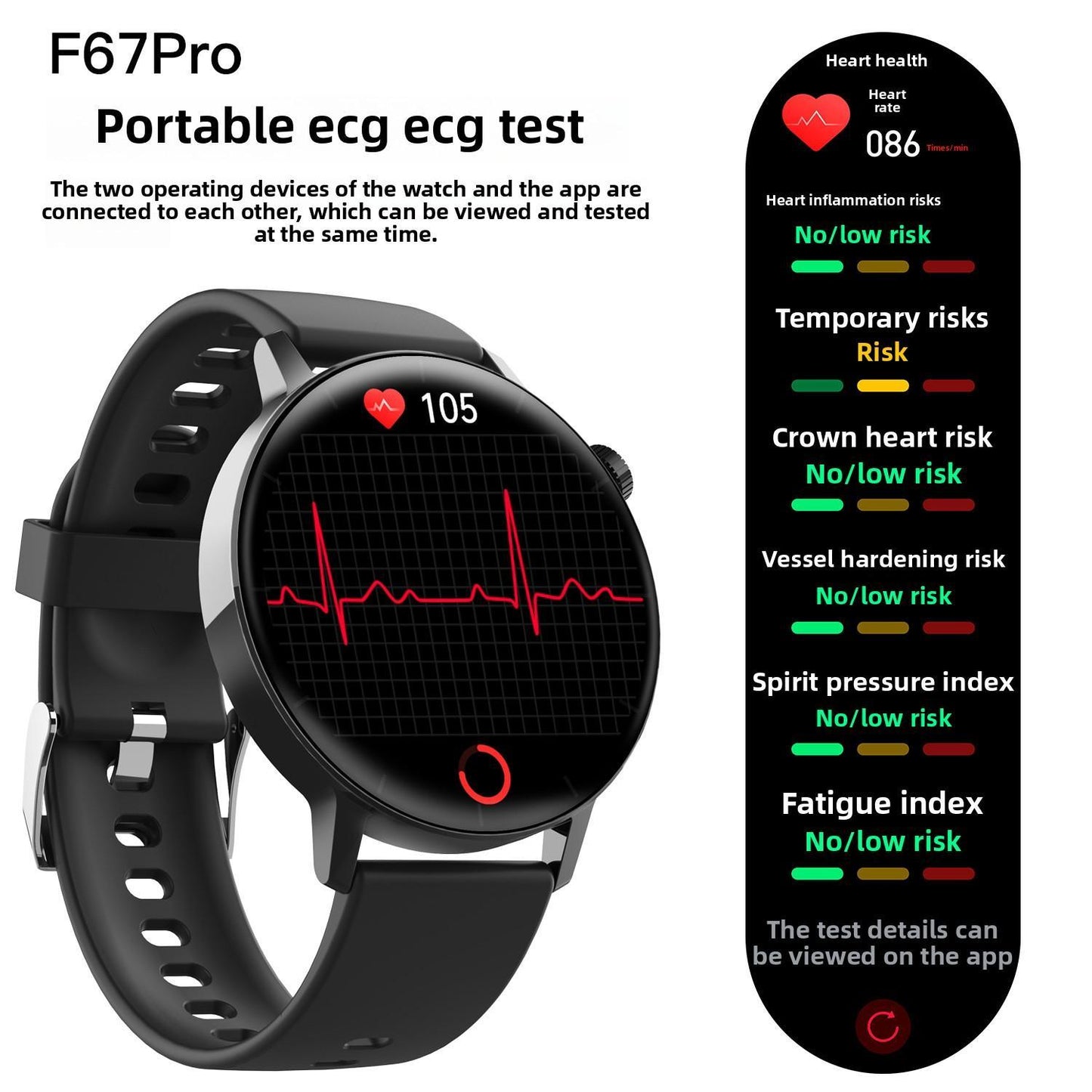 Smart Watch Non-Invasive Blood Glucose Body Temperature Blood Pressure Blood Oxygen Automatic Measurement ECG Ppg Blood Lipid Health Manager - DropOnline.co