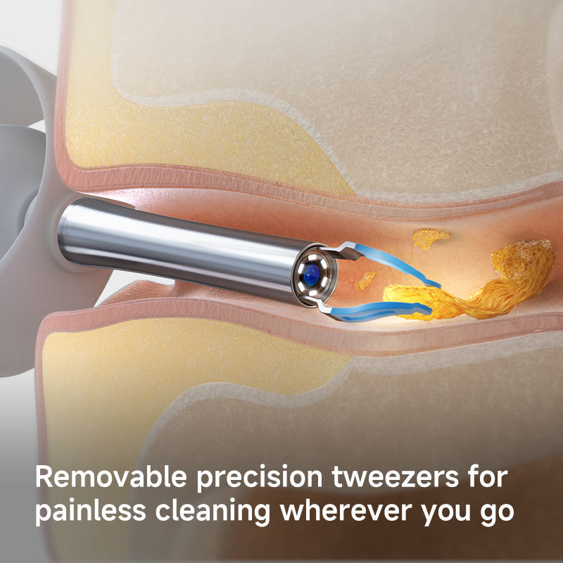 Bebird EarSight Plus Earwax Removal Tool Ear Canal Cleaner, Equipped With A Camera For Ear Nose Throat Examination. - DropOnline.co