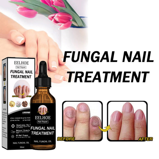 EELHOE Nail Repair Solution Thickening And Shining Nail Removal Dead Skin Repairing And Moisturizing Nail Nutritional Care Liquid - DropOnline.co