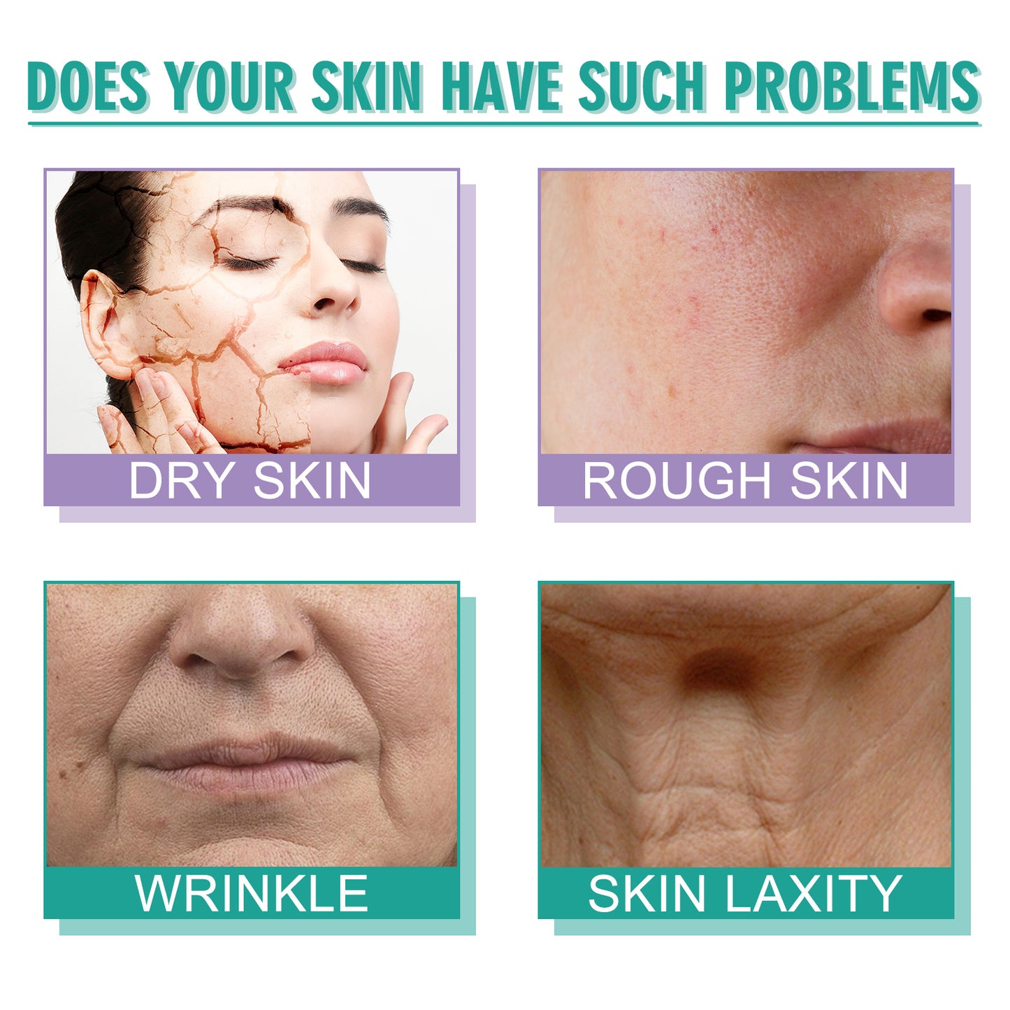 Hoygi Moisturizing Skin Care Cream Lighten Pigmentation Fine Lines Anti-Wrinkle Moisturizing Rejuvenation Whitening Firming Hydrating Cream - DropOnline.co