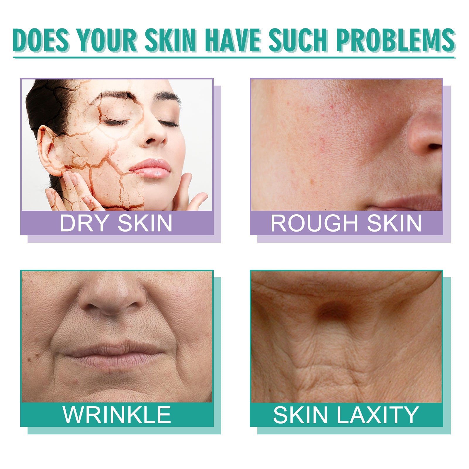 Hoygi Moisturizing Skin Care Cream Lighten Pigmentation Fine Lines Anti-Wrinkle Moisturizing Rejuvenation Whitening Firming Hydrating Cream - DropOnline.co