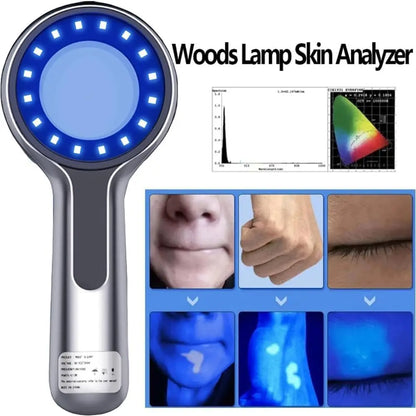 Woods Lamp Skin Analyzer – 365nm UV Light Magnifying Glass for Face Skin Analysis