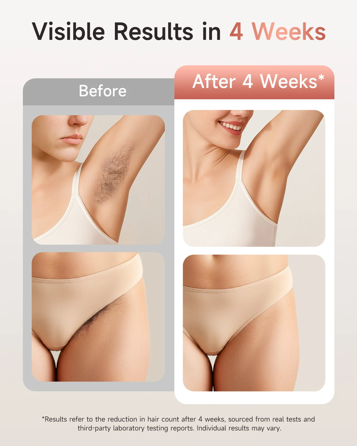3-in-1 IPL Hair Removal Device, 999,900 Flashes