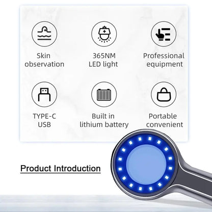 Woods Lamp Skin Analyzer – 365nm UV Light Magnifying Glass for Face Skin Analysis
