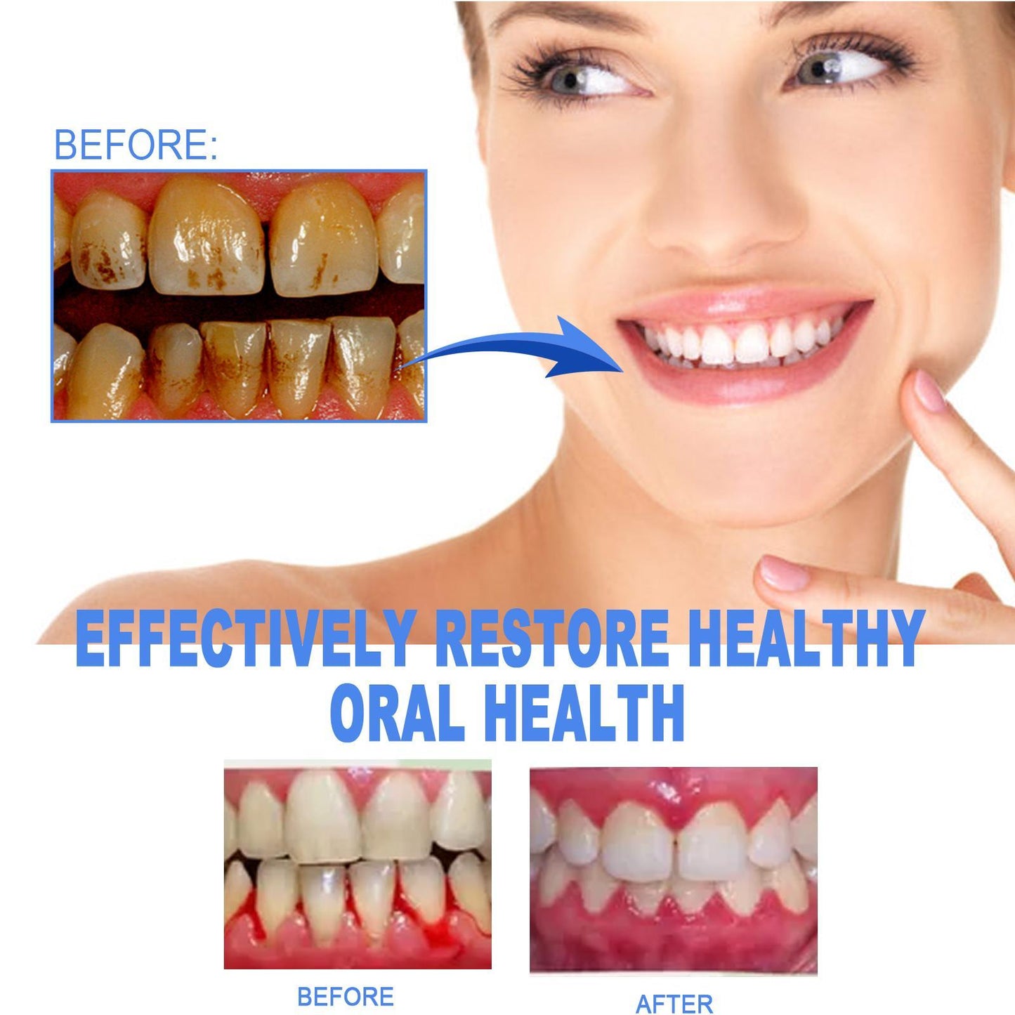 Yierhao Tooth Repair Gel, Repair Gums, Clean Teeth Stains, Tartar, Oral Care - DropOnline.co