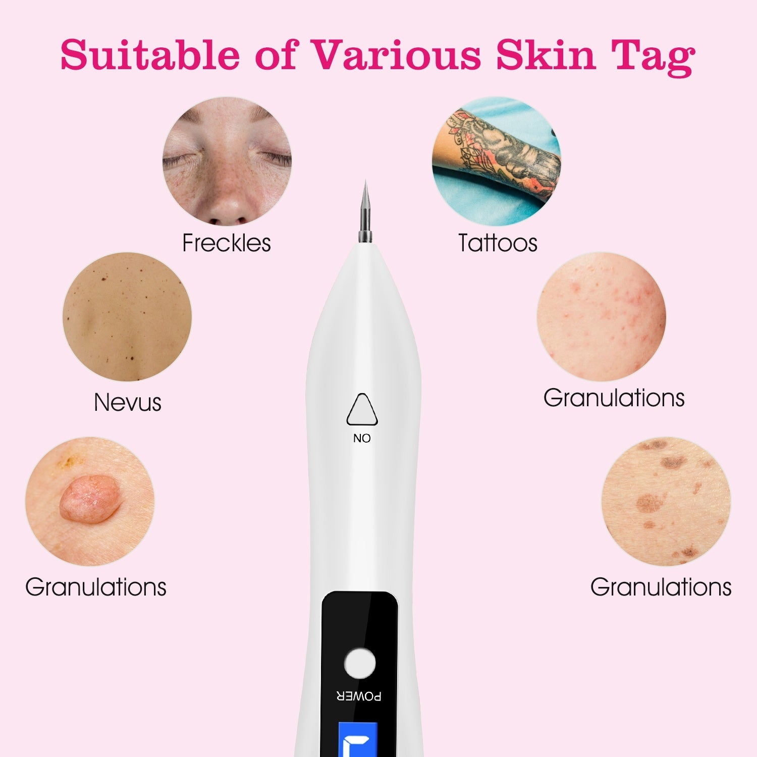 Skin Tag Repair Kit Portable Beauty Equipment Multi-Level With Home Usage USB Charging LCD Level Adjustable 6 Replaceable Needles - DropOnline.co