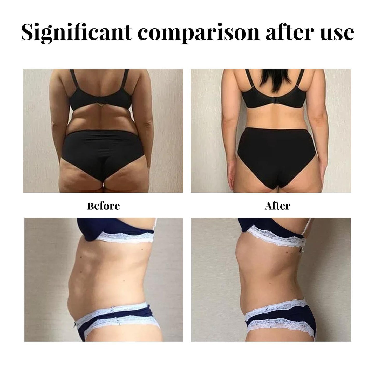 Yihe Abdomen Lifting Belt, Tightens Loose Skin And Reshapes Belly Button - DropOnline.co