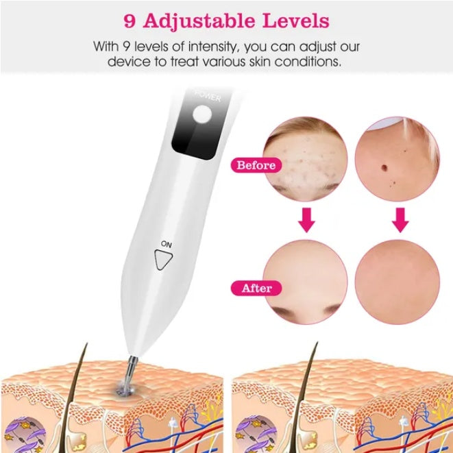 Skin Tag Repair Kit Portable Beauty Equipment Multi-Level - DropOnline.co