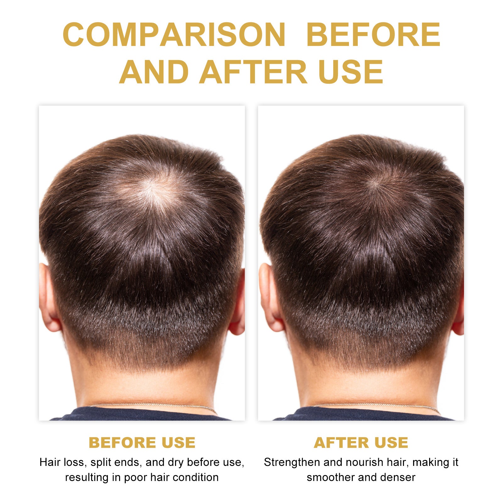 EELHOE Rosemary Hair Treatment Oil Scalp Cleansing Conditioning Volumizing Smoothing Repair Dry Frizzy Hair Conditioning Hair Treatment Oil - DropOnline.co