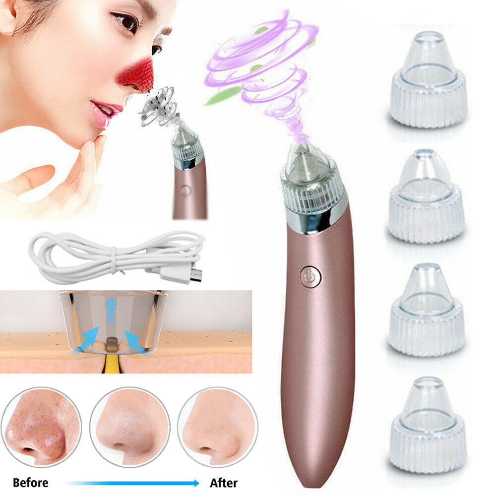 Electric Blackhead Vacuum Pore Cleaner Acne Pimple Remover Strong Suction Tool Electric Blackhead Remover Pore Vacuum Suction Diamond Dermabrasion Face Cleaner - DropOnline.co