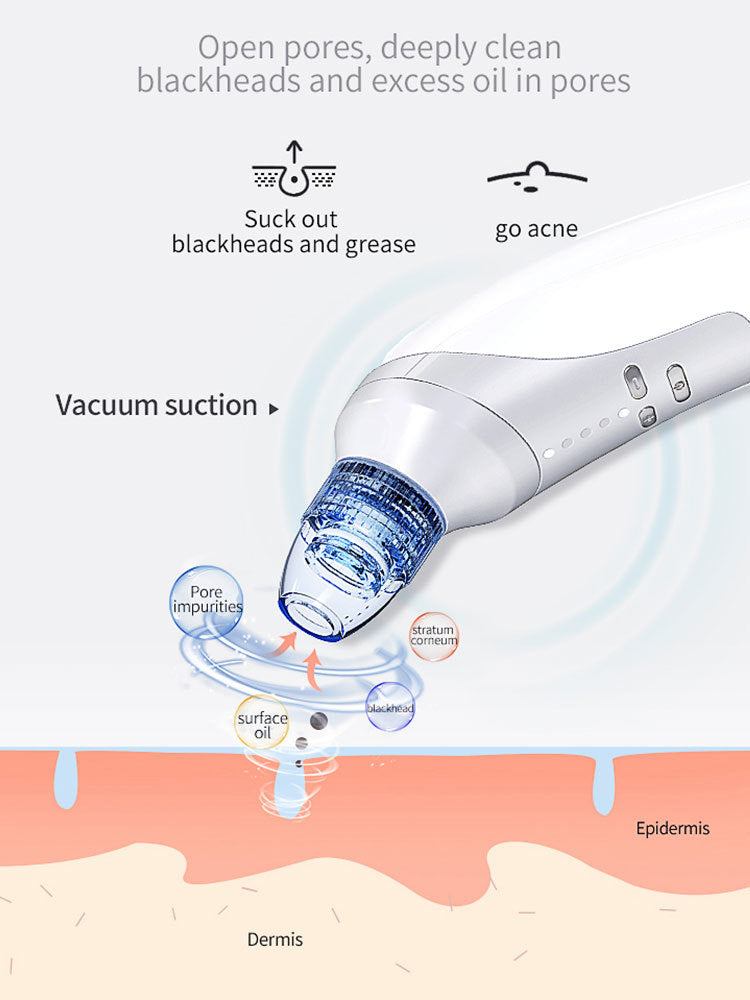 Blackhead Suction Instrument, Electric Blackhead Suction Artifact, Blackhead Removal Instrument, Home Use Beauty Instrument For Sucking Blackheads And Acne - DropOnline.co